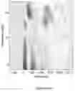 Fig. 59 - Non-invasive brain stimulation