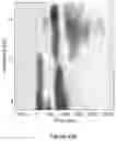 Fig. 60 - Non-invasive brain stimulation