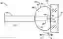 Fig. 01 - MEDICAL LEAD SYSTEM