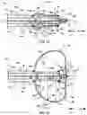 Fig. 07 - MEDICAL LEAD SYSTEM