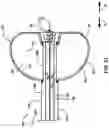 Fig. 14 - MEDICAL LEAD SYSTEM