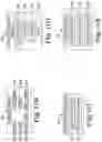 Fig. 10 - ACCELEROMETER-BASED SENSING FOR SLEEP DISORDERED BREATHING (SDB) CARE