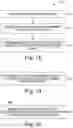 Fig. 14 - ACCELEROMETER-BASED SENSING FOR SLEEP DISORDERED BREATHING (SDB) CARE