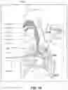 Fig. 02 - Band with built-in stimulator