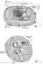 Fig. 25 - Systems and methods to place one or more leads in tissue for providing functional and/or therapeutic stimulation