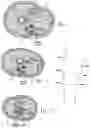 Fig. 26 - Systems and methods to place one or more leads in tissue for providing functional and/or therapeutic stimulation