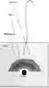 Fig. 01 - Slurry electrodes for direct current nerve conduction block