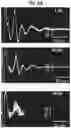 Fig. 19 - Stimulation of a nerve supplying the spleen