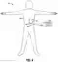 Fig. 03 - User-weighted closed loop adjustment of neuromodulation treatment