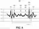 Fig. 05 - METHOD AND APPARATUS FOR ESTABLISHING PARAMETERS FOR CARDIAC EVENT DETECTION