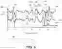 Fig. 06 - METHOD AND APPARATUS FOR ESTABLISHING PARAMETERS FOR CARDIAC EVENT DETECTION
