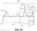 Fig. 21 - METHOD AND APPARATUS FOR ESTABLISHING PARAMETERS FOR CARDIAC EVENT DETECTION