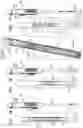 Fig. 02 - IMPLANT AND DELIVERY TOOL THEREFOR