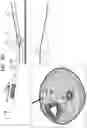 Fig. 06 - IMPLANT AND DELIVERY TOOL THEREFOR
