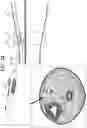 Fig. 07 - IMPLANT AND DELIVERY TOOL THEREFOR