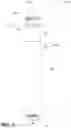 Fig. 04 - Leadless pacemaker systems, devices and methods that monitor for atrial capture