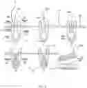 Fig. 04 - NOVEL PERIPHERAL NERVE INTERFACE DEVICE
