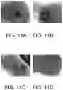 Fig. 10 - COLD AIR PLASMA GENERATING APPARATUS