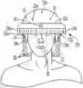 Fig. 01 - DEVICE PROVIDING NEUROTHERAPEUTIC INTERVENTION VIA MULTI-MODAL ENERGY THERAPY