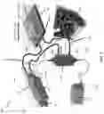 Fig. 06 - SYSTEMS AND METHODS FOR AESTHETIC TREATMENT