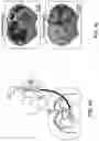 Fig. 21 - Thalamic Input to Orbitofrontal Cortex Drives Brain-Wide, Frequency-Dependent Inhibition Mediated By GABA and Zona Incerta