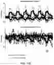 Fig. 50 - Thalamic Input to Orbitofrontal Cortex Drives Brain-Wide, Frequency-Dependent Inhibition Mediated By GABA and Zona Incerta