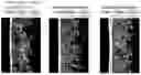Fig. 01 - Skin External Preparation for Cellulite Improvement and Cellulite Improvement Method