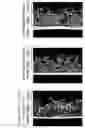 Fig. 02 - Skin External Preparation for Cellulite Improvement and Cellulite Improvement Method