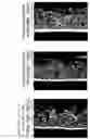 Fig. 03 - Skin External Preparation for Cellulite Improvement and Cellulite Improvement Method