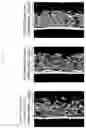 Fig. 05 - Skin External Preparation for Cellulite Improvement and Cellulite Improvement Method