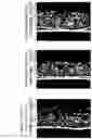 Fig. 07 - Skin External Preparation for Cellulite Improvement and Cellulite Improvement Method