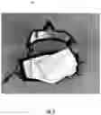 Fig. 09 - Facemask Having Improved Fit and Construction