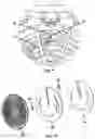 Fig. 09 - Settable Length Fall Arrest Device