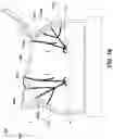 Fig. 33 - DAP system adjustments via flexible restraints and related devices, systems and methods