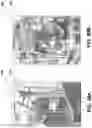 Fig. 46 - DAP system adjustments via flexible restraints and related devices, systems and methods