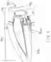 Fig. 10 - MULTI-MATERIAL GOLF CLUB HEAD