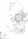 Fig. 13 - Manipulation input device