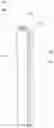 Fig. 12 - AIR PURIFICATION FILTER AND AIR PURIFIER INCLUDING SAME