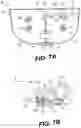 Fig. 11 - KIT AND SYSTEM FOR LASER-INDUCED MATERIAL DISPENSING