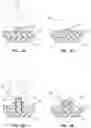 Fig. 03 - Airbag cover emblem coupling methods and related assemblies