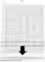 Fig. 02 - PRIMER, PROBE AND KIT FOR TUBERCULOSIS DIAGNOSIS USING URINE SAMPLE, AND USES THEREOF