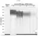 Fig. 08 - PRIMER, PROBE AND KIT FOR TUBERCULOSIS DIAGNOSIS USING URINE SAMPLE, AND USES THEREOF