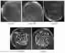 Fig. 03 - Method for preparing large size beta-type ammonium tetramolybdate monocrystal particle