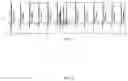 Fig. 09 - METHOD AND SYSTEM FOR ANALYZING CARDIAC ACTIVITY BY MODELLING CARDIAC M-CELLS