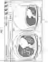 Fig. 02 - Medical image processing device, method, and programs that cut out region from second medical image to generate second partial image for superimpose on first medical image, and medical image display system