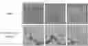 Fig. 01 - MEDICAL IMAGE SYNTHESIS FOR MOTION CORRECTION USING GENERATIVE ADVERSARIAL NETWORKS