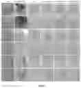 Fig. 07 - MEDICAL IMAGE SYNTHESIS FOR MOTION CORRECTION USING GENERATIVE ADVERSARIAL NETWORKS