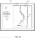 Fig. 07 - Systems and methods for planning a patient-specific spinal correction