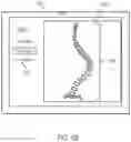 Fig. 08 - Systems and methods for planning a patient-specific spinal correction