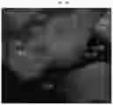 Fig. 35 - METHOD FOR MANUFACTURING IMPLANT SHAPE FOR MINIMIZING THE STRESS APPLIED TO IMPLANT BY USING COMPUTER, AND METHOD AND APPARATUS FOR RECOMMENDING OPTIMAL OCCLUSAL AREA FOR IMPLANT BY USING COMPUTER